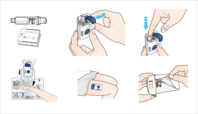 レパサの投与量