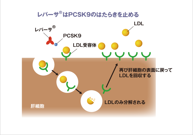 レパサの注意事項