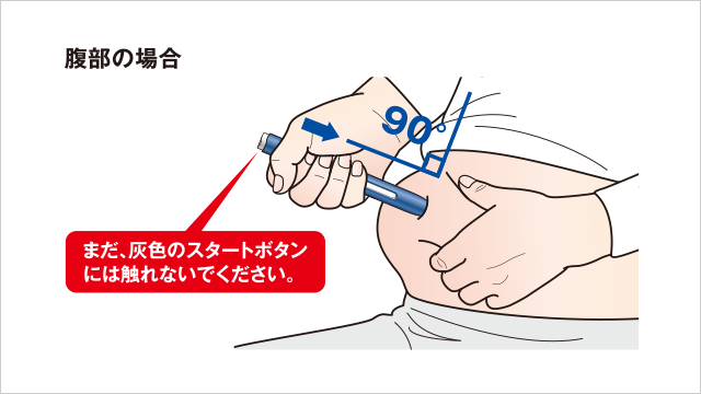 皮下注射