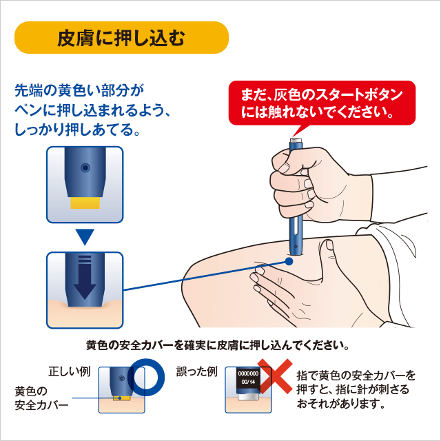 めるたん様注文ページ イラストでみる使い方 ステップ3：注射する｜レパーサ®皮下注