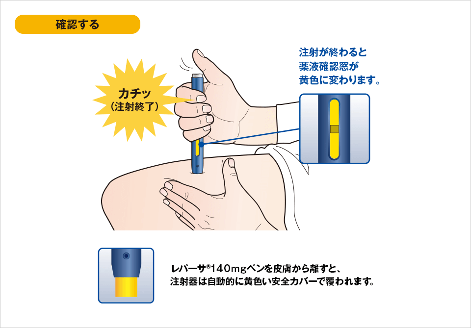 イラストでみる使い方 ステップ3：注射する｜レパーサ®皮下注
